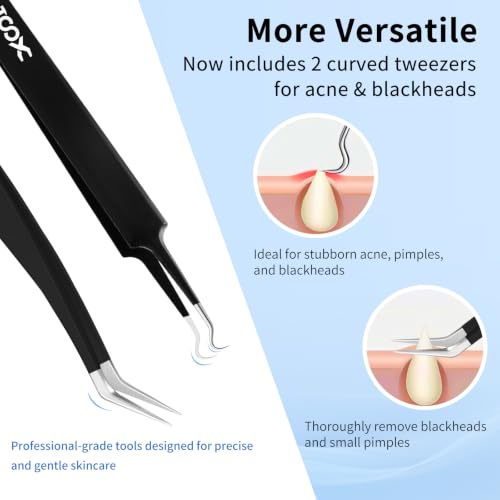 XOOL 10 PCS ESD Precision Tweezers Set, Anti-Static Stainless Steel Tweezers Kit for Electronics, Soldering, Craft, Jewelry, Model Building, Beauty - size: ESD Tweezers 10 PCS