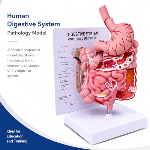 Human Digestive System Model with Removable Stomach, GI-Tract and Colon, Includes Product Manual