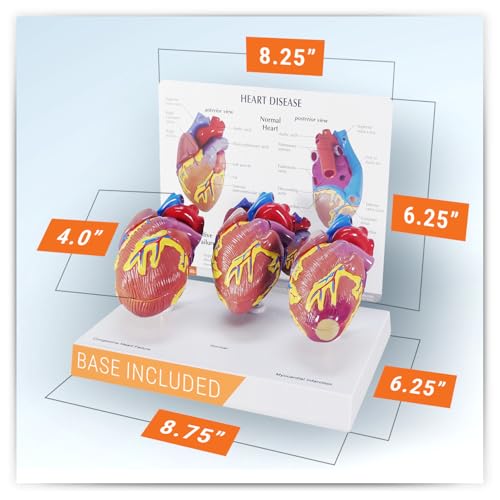 GPI Anatomicals 3-Piece Mini Heart Model Set, Normal and Diseased - style: Mini-Heart Model