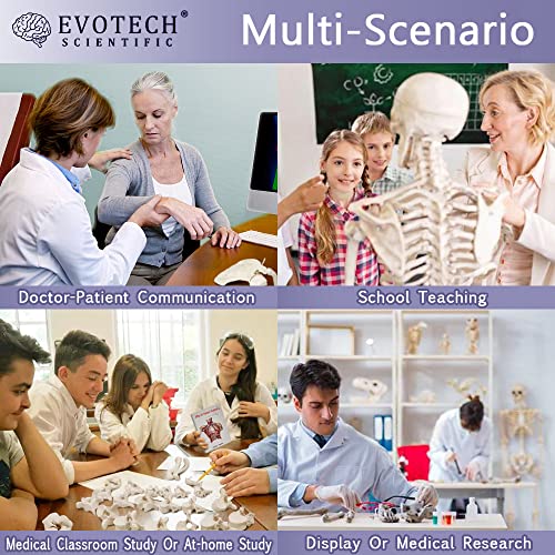 EVOTECH Disarticulated Human Skeleton Model for Anatomy 67'' Full Size
