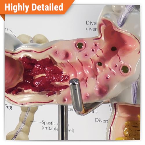 GPI Anatomicals Colon Model
