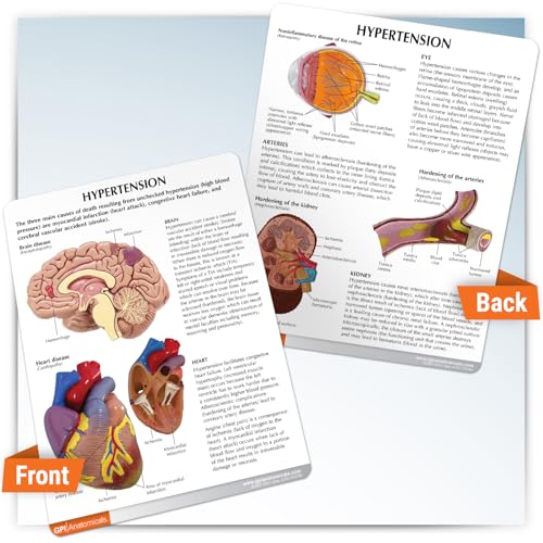 GPI Anatomicals Hypertension Model Set - style: Hypertension Model