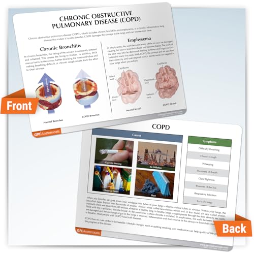 GPI Anatomicals Chronic Obstructive Pulmonary Disease (COPD) Model