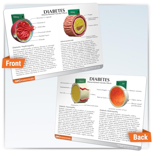 GPI Anatomicals 4-Piece Diabetes Model, Replica with Pathologies - style: Diabetes Model
