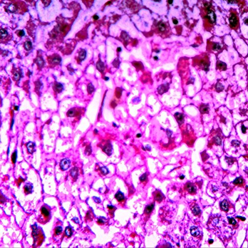 VSH115 Prepared Slide Set – Human Pathology (Set of 12)