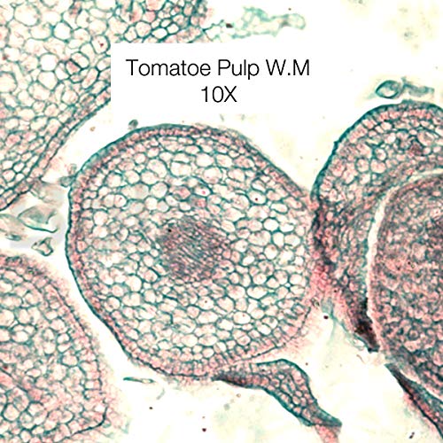 BoliOptics 100 Prepared Microscope Slides General Biology Specimen Set Plant Animal Human Anatomy Cells for Students Hobbyists Beginners Kids Homeschool, SL39901008