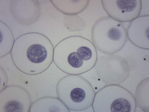 EISCO Ascaris & Onion Mitosis, Prepared Microscope Slide - 75 x 25mm - Plant & Animal Mitosis, Introductory Microscopy - size: Single Slide