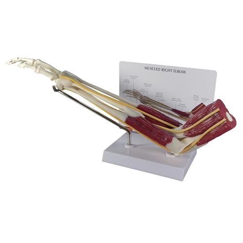 GPI Anatomicals Muscled Elbow ModelModel of Right Elbow with Muscles - style: Muscled Elbow