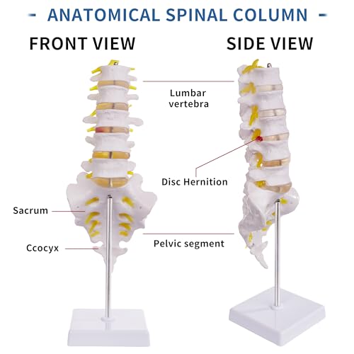 Lumbar Spine Model for Anatomy Education, Life Size Human Lumbar Model with 5 Vertebrae Sacrum, Spinal Disc, and Sturdy Base, Ideal Tool for Medical Teaching and Learning - style: Lumbar Spine Model