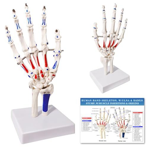 EVOTECH SCIENTIFIC Hand Skeleton Model W/Muscles Insertions&Origins Painted