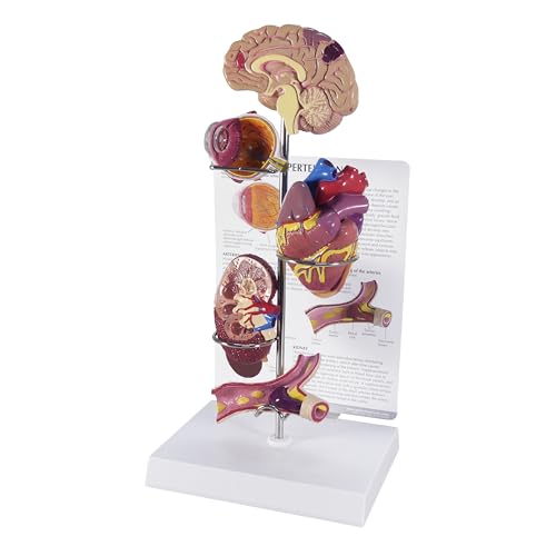 GPI Anatomicals Hypertension Model Set - style: Hypertension Model