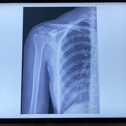 X-ray Science Education Package for Human Anatomy and Bone Parts is Suitable for Light Table and lamp Fittings.