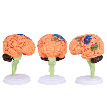 Brain Model, 32-Part Detachable Anatomy Kit
