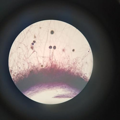 Aspergillus Prepared Microscope Slides, 5 Pack Aspergillus Slides Show Fungal Spores, Learn About The Structure of Brown Mold and Reproduction