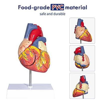 2X Enlarged Anatomical Heart Model - Human Heart Model with Rigth/Left Atrial Appendage Anatomical Model for Science Classroom and Cardiology Study