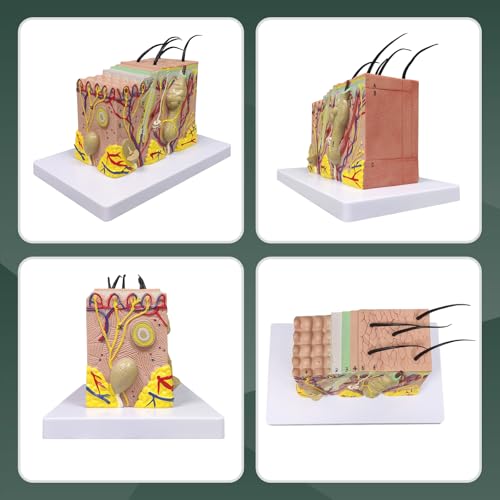 Ultrassist Skin Anatomy Model, 35X Teaching Display