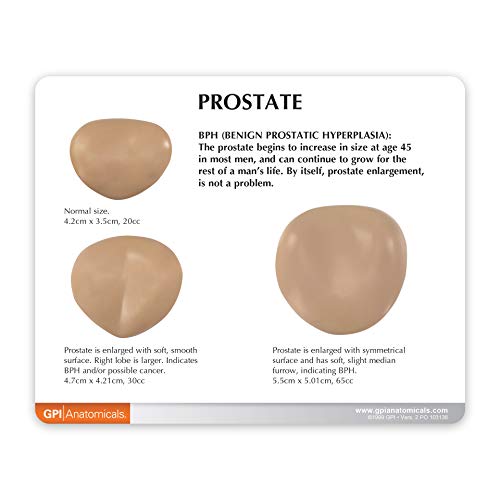 GPI Anatomicals Human Anatomy Model of Male Pelvis with 3D Prostate Frame - style: Male Pelvis with 3D Prostate Frame