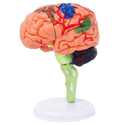 32-Piece Human Brain Anatomy Model with Display Stand, 4.3-Inch Detachable Brain Replica for Adult Anatomy Study, College Biology, Nursing and Medical Education