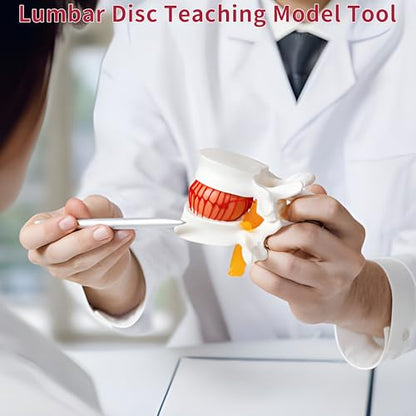 Human Anatomical Lumbar Disc Herniation Model, 1.5 Times Life Size Lumbar Vertebrae Disc Herniation Model, Portable Lumbar Spine Model for Medical, Teaching and Demonstrating - style: Anatomical Lumbar Disc Herniation Model