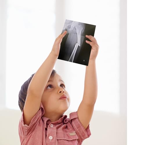 Human Body Activities & Experiments Science Kit for Kids,Human Anatomy Body Parts with Broken Bones X Ray,Lung Breathing Model, Vessels, Digestive System,Muscles Model,Skeleton,Human Organ STEM 5+