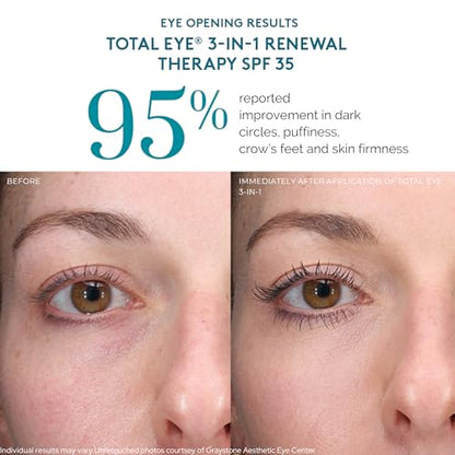 Colorescience, Total Eye 3-in-1 Renewal Therapy, SPF 35 - color: Deep