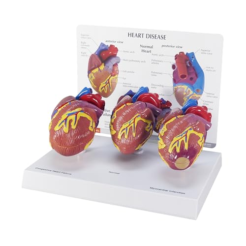 GPI Anatomicals 3-Piece Mini Heart Model Set, Normal and Diseased - style: Mini-Heart Model