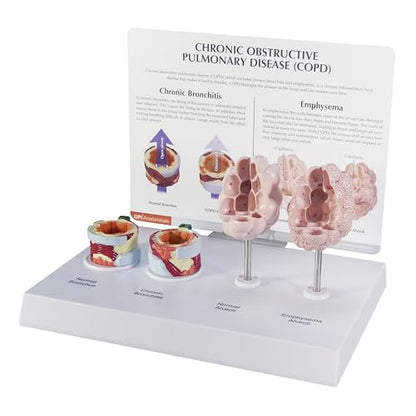 GPI Anatomicals Chronic Obstructive Pulmonary Disease (COPD) Model