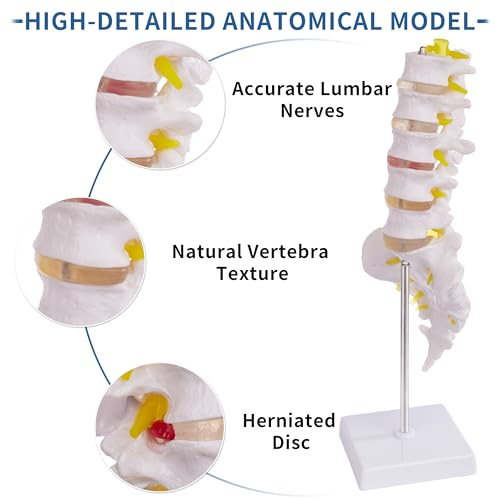 Lumbar Spine Model for Anatomy Education, Life Size Human Lumbar Model with 5 Vertebrae Sacrum, Spinal Disc, and Sturdy Base, Ideal Tool for Medical Teaching and Learning - style: Lumbar Spine Model