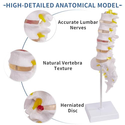 Lumbar Spine Model for Anatomy Education, Life Size Human Lumbar Model with 5 Vertebrae Sacrum, Spinal Disc, and Sturdy Base, Ideal Tool for Medical Teaching and Learning - style: Lumbar Spine Model