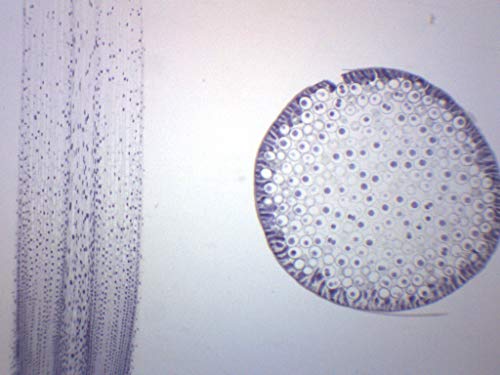 EISCO Ascaris & Onion Mitosis, Prepared Microscope Slide - 75 x 25mm - Plant & Animal Mitosis, Introductory Microscopy - size: Single Slide