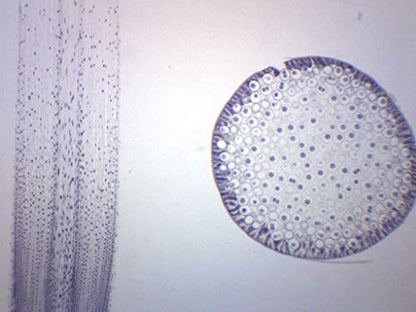 EISCO Ascaris & Onion Mitosis, Prepared Microscope Slide - 75 x 25mm - Plant & Animal Mitosis, Introductory Microscopy - size: Single Slide
