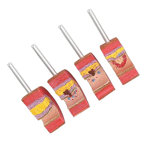 Anatomy Replica Model, Atherosclerosis Human Body Artery Model Bright Colors Simulation Ecofriendly PVC for Educational Tool