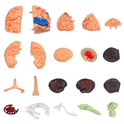 Brain Model, 32-Part Detachable Anatomy Kit