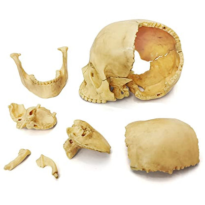 Anatomy Exploded Human Skull Model,Medical Model Dental Clinic