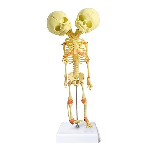 EVOTECH SCIENTIFIC Human Infant Skeleton Model, Twin-Skull, Human Fetus Skeleton W/Double-Skull Model for Medical Study Teaching Display