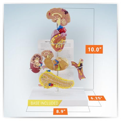 GPI Anatomicals Metabolic Syndrome Model Set - style: Metabolic Syndrome Model