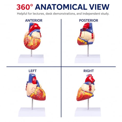 2X Enlarged Anatomical Heart Model, 4-Part, 49 Structures - size: 2X Enlarged 49 Anatomical Structures Model