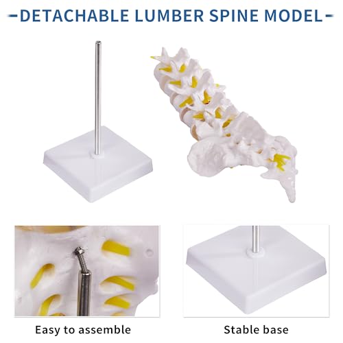 Lumbar Spine Model for Anatomy Education, Life Size Human Lumbar Model with 5 Vertebrae Sacrum, Spinal Disc, and Sturdy Base, Ideal Tool for Medical Teaching and Learning - style: Lumbar Spine Model