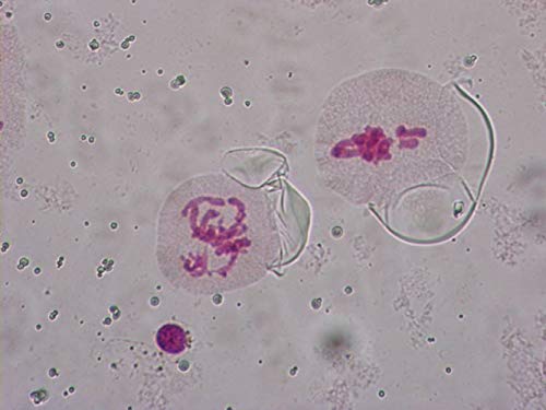 Prepared Animal Plant Cell Mitosis Meiosis Amitosis Comparison Microscope Slides Set, 5pcs Specimens to Display with Students in Biology Class (Mitosis & Meiosis)