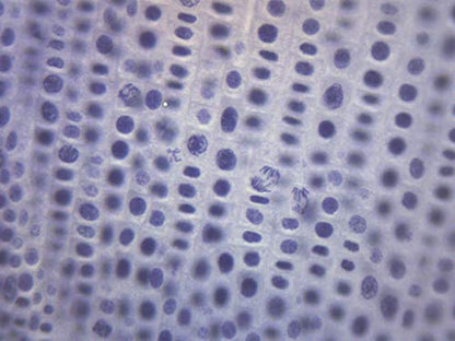 Eisco Onion Mitosis Slides, Prepared Microscope Slides, 75 x 25mm, 10 Pack