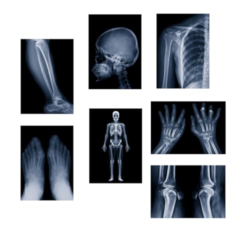 X-ray Science Education Package for Human Anatomy and Bone Parts is Suitable for Light Table and lamp Fittings.