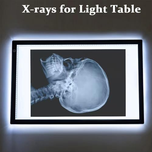 X-ray Science Education Package for Human Anatomy and Bone Parts is Suitable for Light Table and lamp Fittings.