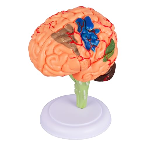 Brain Model, 32-Part Detachable Anatomy Kit