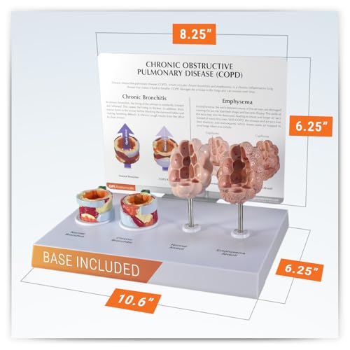 GPI Anatomicals Chronic Obstructive Pulmonary Disease (COPD) Model