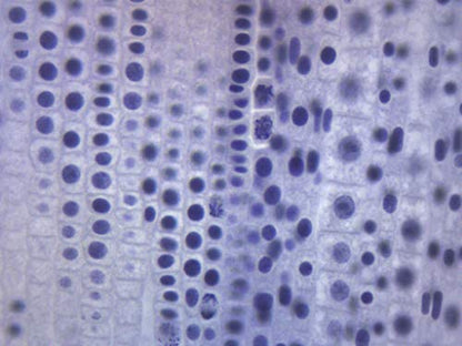 EISCO Ascaris & Onion Mitosis, Prepared Microscope Slide - 75 x 25mm - Plant & Animal Mitosis, Introductory Microscopy - size: Single Slide