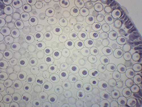 EISCO Ascaris & Onion Mitosis, Prepared Microscope Slide - 75 x 25mm - Plant & Animal Mitosis, Introductory Microscopy - size: Single Slide