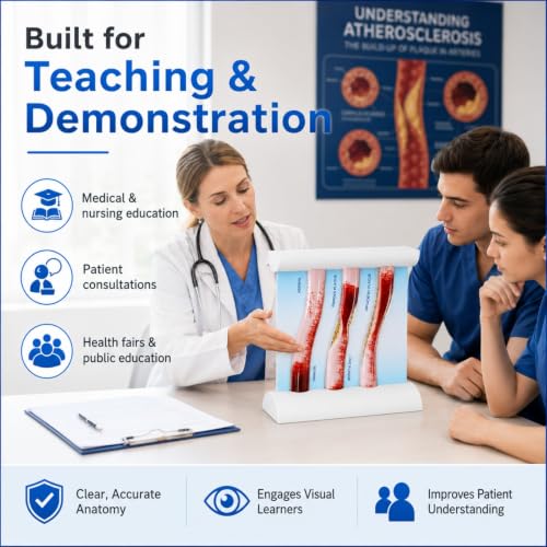 Atherosclerosis Artery Model, LDL Plaque Cardiovascular Teaching Aid