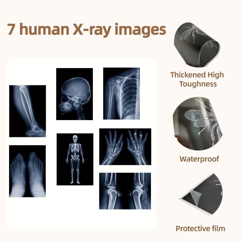 X-ray Science Education Package for Human Anatomy and Bone Parts is Suitable for Light Table and lamp Fittings.