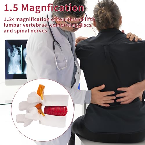 Human Anatomical Lumbar Disc Herniation Model, 1.5 Times Life Size Lumbar Vertebrae Disc Herniation Model, Portable Lumbar Spine Model for Medical, Teaching and Demonstrating - style: Anatomical Lumbar Disc Herniation Model
