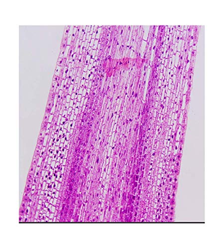 Onion Root Tips Mitosis Microscope Slides Set, 25PCS Pack Slides Show Plant Mitosis for Biology Science Class (25 Count) - color: 25 count